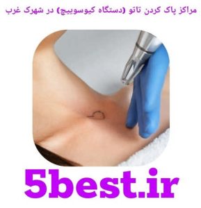 مراکز پاک کردن تاتو ( دستگاه کیوسوییچ ) در شهرک غرب