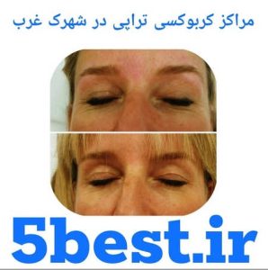 مراکز کربوکسی تراپی در شهرک غرب