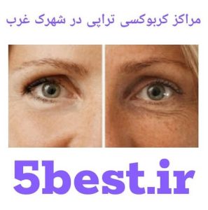 مراکز کربوکسی تراپی در شهرک غرب