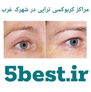 مراکز کربوکسی تراپی در شهرک غرب