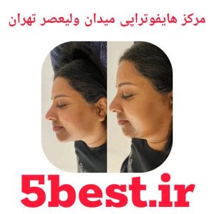مرکز هایفوتراپی میدان ولیعصر تهران