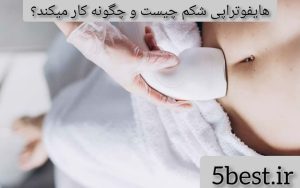 هایفوتراپی شکم چیست و چگونه کار میکند؟