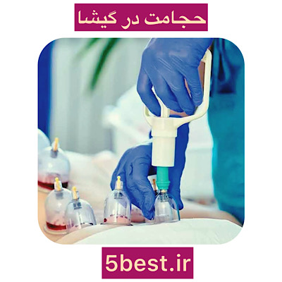 حجامت در گیشا