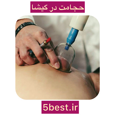حجامت در گیشا