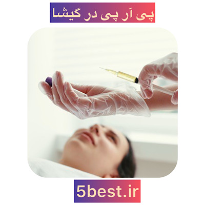 پی ار پی در گیشا