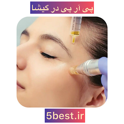 پی ار پی در گیشا