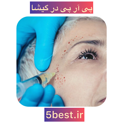 پی ار پی در گیشا