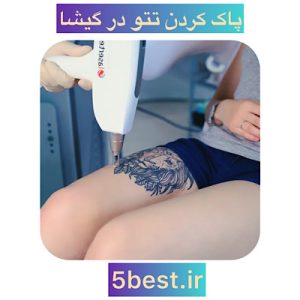 پاک کردن تتو در گیشا