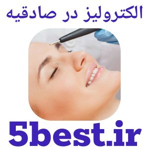 الکترولیز در صادقیه