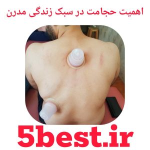 اهمیت حجامت در سبک زندگی مدرن