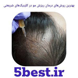 بهترین روش‌های درمان ریزش مو در کلینیک‌های شریعتی