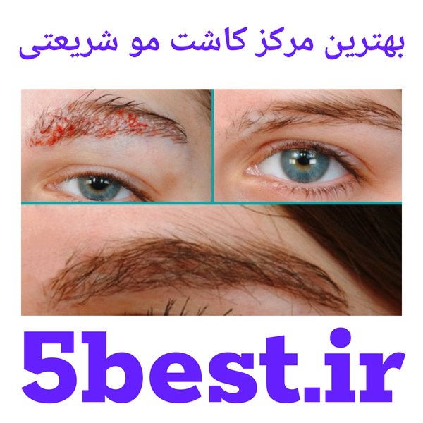بهترین مرکز کاشت ابرو شریعتی