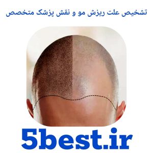 تشخیص علت ریزش مو و نقش پزشک متخصص
