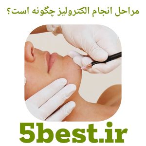 مراحل انجام الکترولیز چگونه است؟