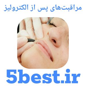 مراقبت‌های پس از الکترولیز