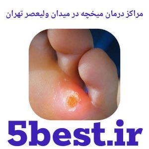 مراکز درمان میخچه در میدان ولیعصر تهران