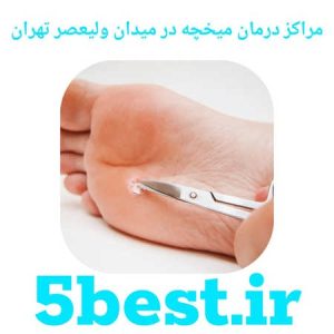 مراکز درمان میخچه در میدان ولیعصر تهران