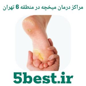 مراکز درمان میخچه منطقه 6 تهران