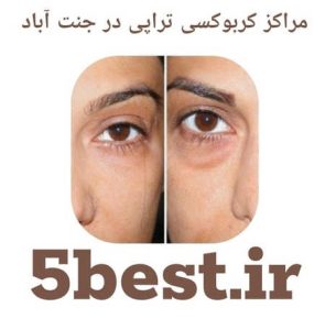 مراکز کربوکسی تراپی در جنت اباد