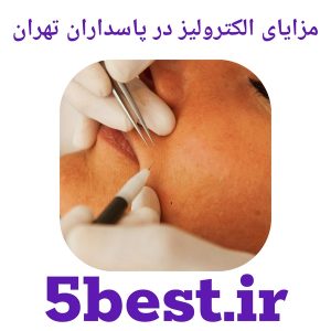 مزایای الکترولیز در پاسداران تهران