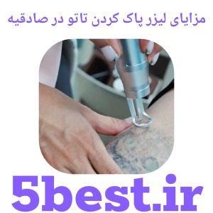 مزایای لیزر پاک کردن تاتو در صادقیه