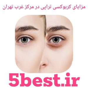 مزایای کربوکسی تراپی در مرکز غرب تهران