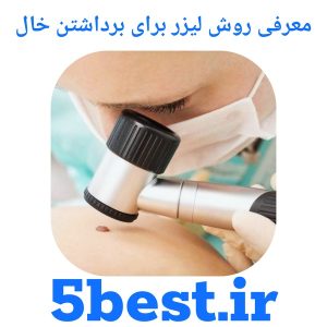 معرفی روش لیزر برای برداشتن خال