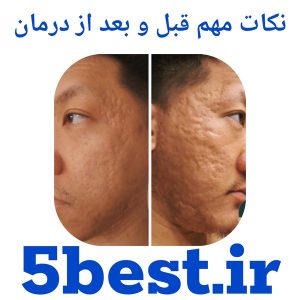 نکات مهم قبل و بعد از درمان