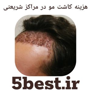 هزینه کاشت مو در مراکز شریعتی