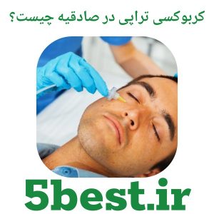 کربوکسی تراپی در صادقیه چیست؟