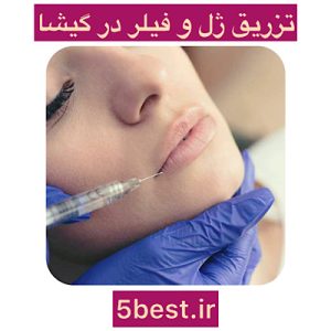 تزریق ژل و فیلر در گیشا