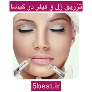 تزریق ژل و فیلر در گیشا