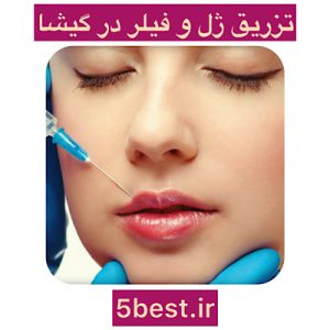 تزریق ژل و فیلر در گیشا