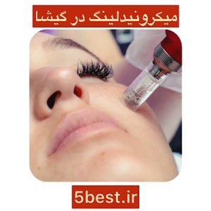 میکرونیدلینگ در گیشا
