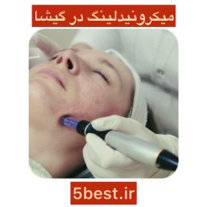 میکرونیدلینگ در گیشا