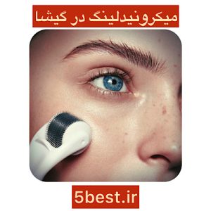 میکرونیدلینگ در گیشا