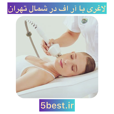 کویتیشن در شمال تهران