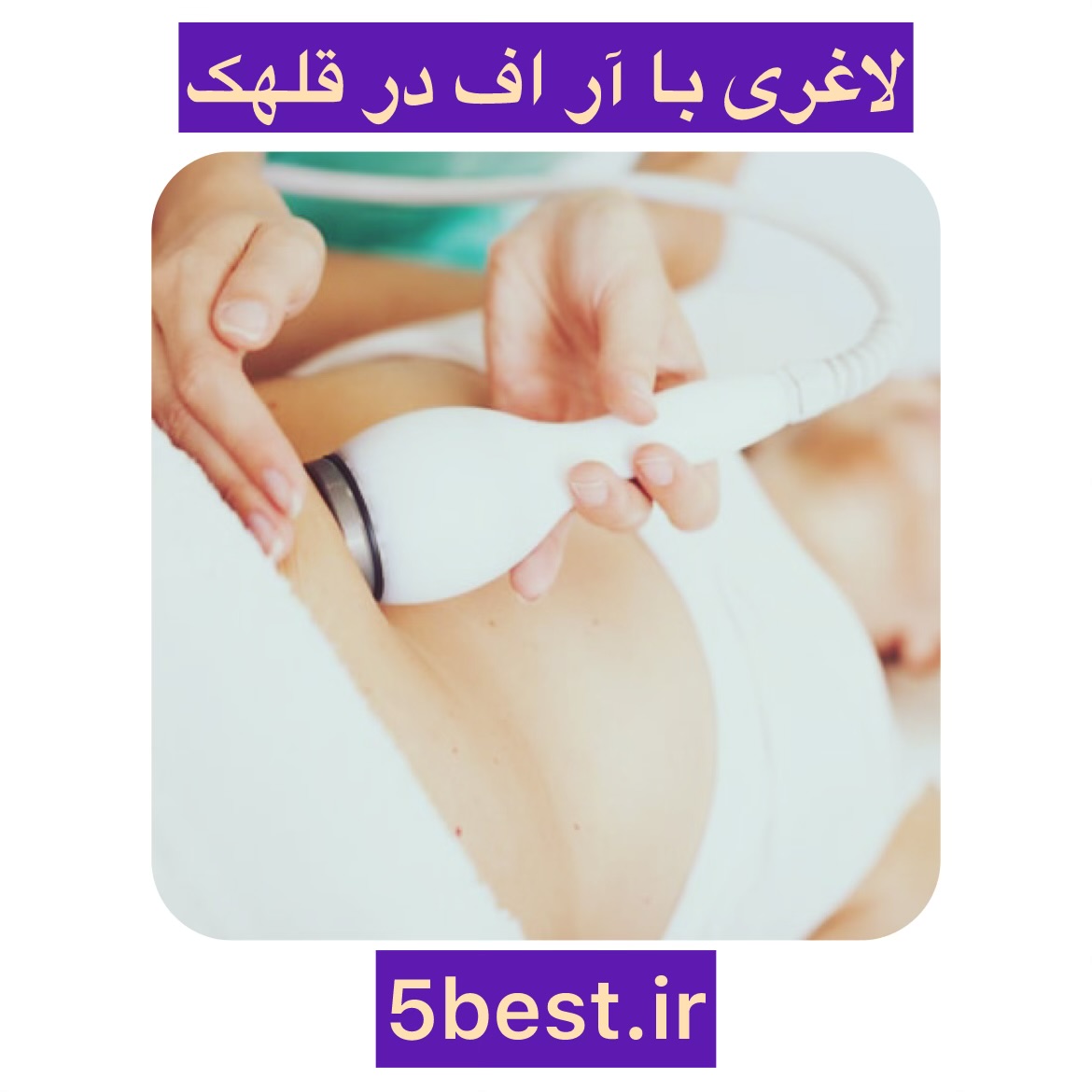 کویتیشن در قلهک