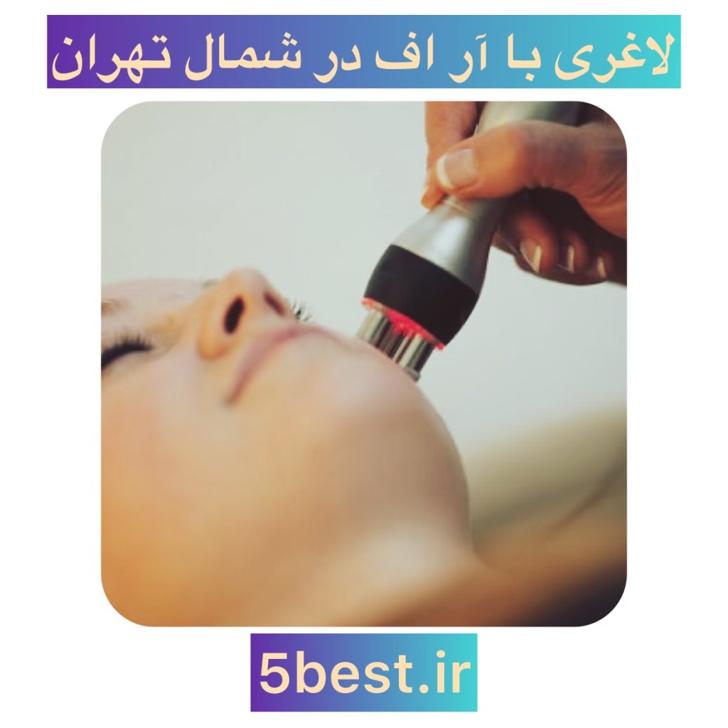 کویتیشن در شمال تهران