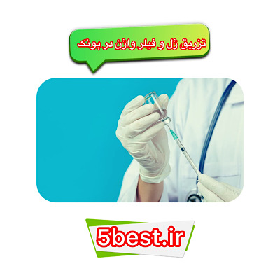 تزریق ژل و فیلر واژن در پونک