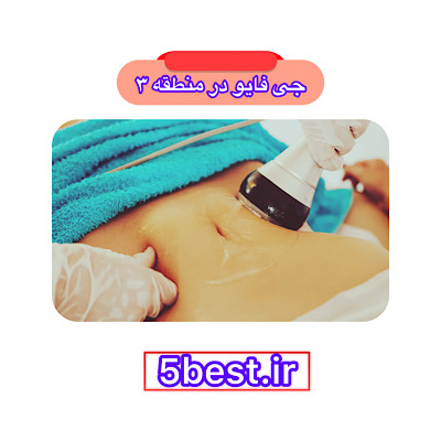 جی فایو در منطقه 3