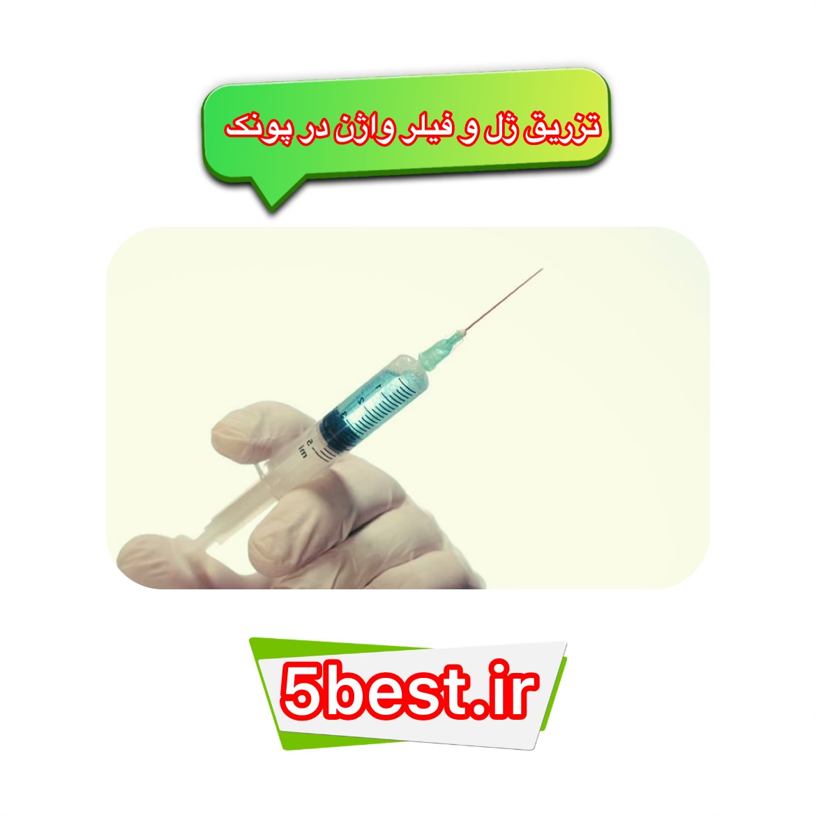 تزریق ژل و فیلر واژن در پونک