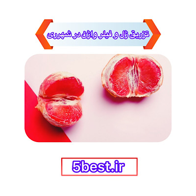 تزریق ژل و فیلر واژن در شهرری