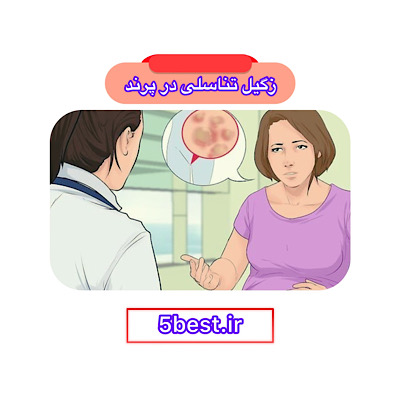 زگیل تناسلی در پرند