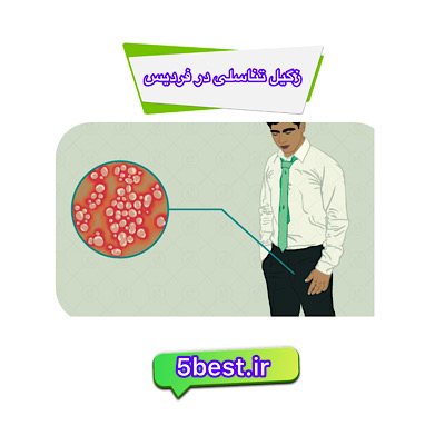 زگیل تناسلی در فردیس