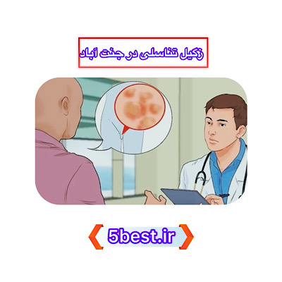 زگیل تناسلی در جنت آباد