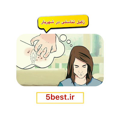 زگیل تناسلی در شهریار