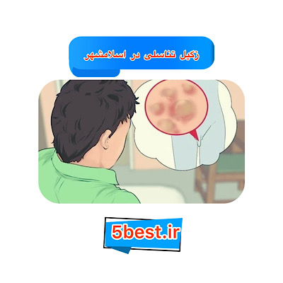 زگیل تناسلی در اسلامشهر