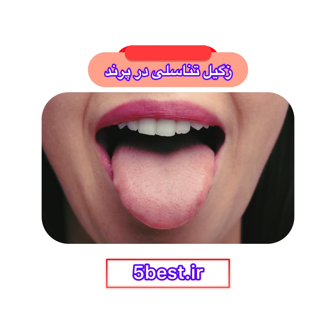 زگیل تناسلی در پرند