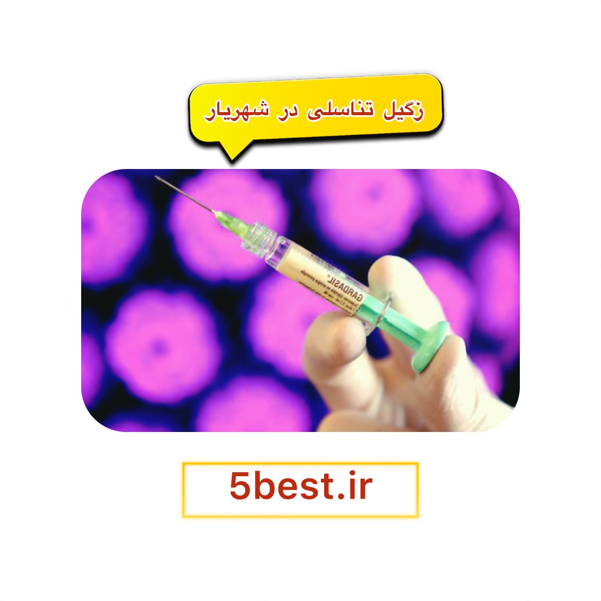 زگیل تناسلی در شهریار